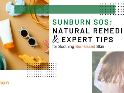 Sunburn SOS: Natural Remedies and Expert Tips for Soothing Sun-kissed Skin