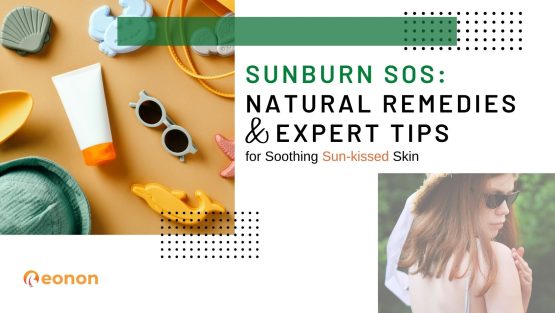 Sunburn SOS: Natural Remedies and Expert Tips for Soothing Sun-kissed Skin